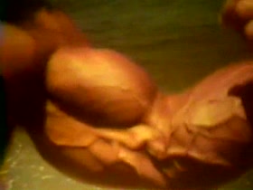 Vascular Gunz