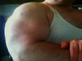 Thumb 1