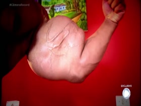 Thumb 18